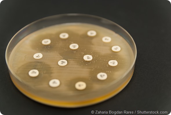 Petri dish antibiogram on black background. Escherichia Colli bacteria on petri dish. Shallow depth of field