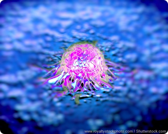 Prostate Cancer Cell