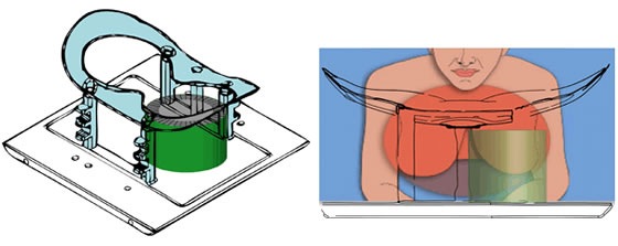 Conceptual drawings of the simultaneous PET/MRI breast imaging system being developed at Brookhaven Lab showing the how the PET insert (green) fits inside the MRI scanner and how it will be used with breast cancer patients.