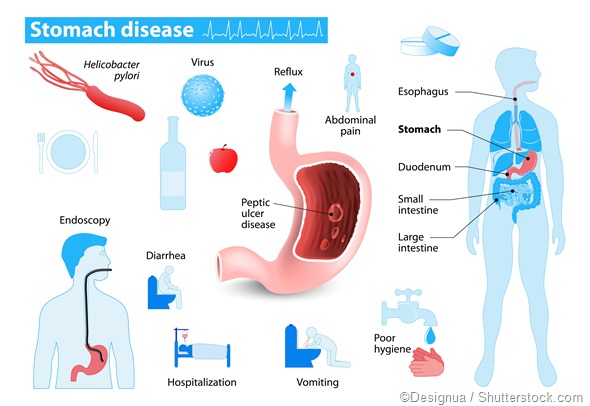 Stomach disease infrographic