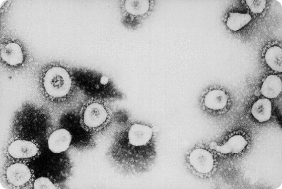 Transmission electron micrograph of coronavirus OC43: The coronavirus is now recognized as the etiologic agent of the 2003 SARS outbreak. Additional specimens are being tested to learn more about this coronavirus, and its etiologic link with Severe Acute Respiratory Syndrome. Credit: CDC/ Dr. Erskine Palmer