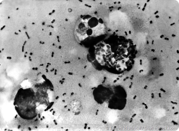 Yersinia pestis bacteria which caused Bubonic Plague, 1965