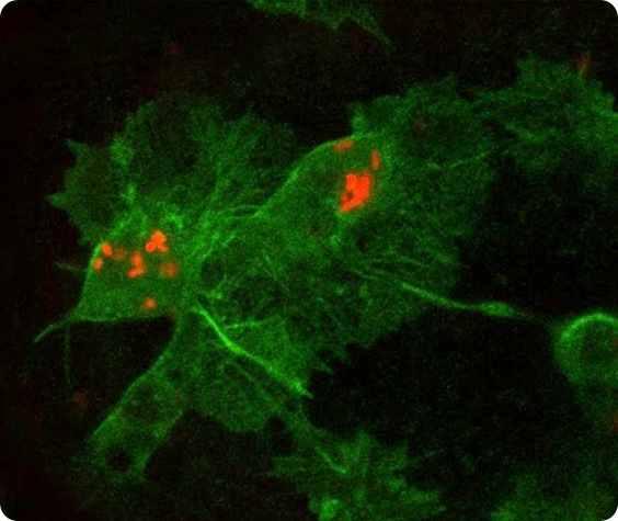 Confocal microscope image showing insect immune cells (green) containing fluorescently labelled E.coli (red).