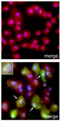 Fluorescence microscopy shows breast cancer cells treated with a dye-sensitized ruthenium nitrosyl before (top) and after (bottom) exposure to light, which triggers the release of nitric oxide, leading to cell death. (Image from Rose et al., 2008, JACS.)