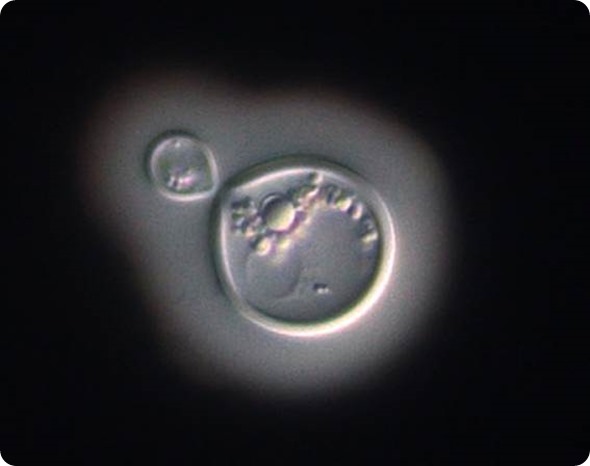 Dividing Cryptococcus neoformans cell stained with India Ink. India Ink is excluded from the polysaccharide capsule surrounding the Cryptococcus cell, resulting in the appearance of a halo around the cell. Image courtesy of Z Li and K Nielsen.