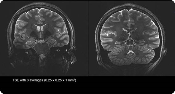 Increasing access to MRI scanning