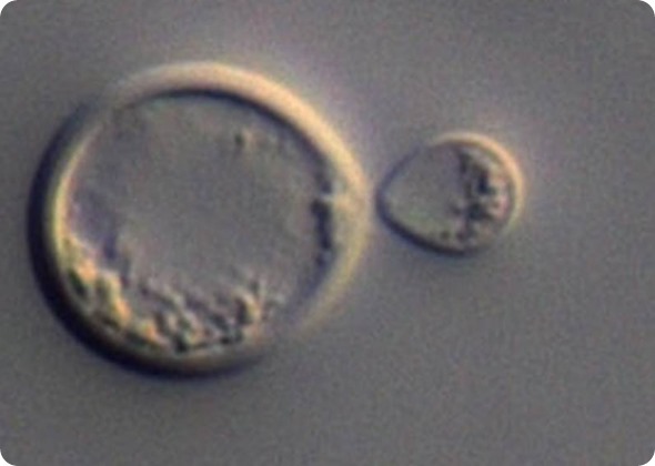 A Cryptococcus neoformans titan cell dividing to produce a mutant daughter cell. Image courtesy of LH Okagaki and K Nielsen.