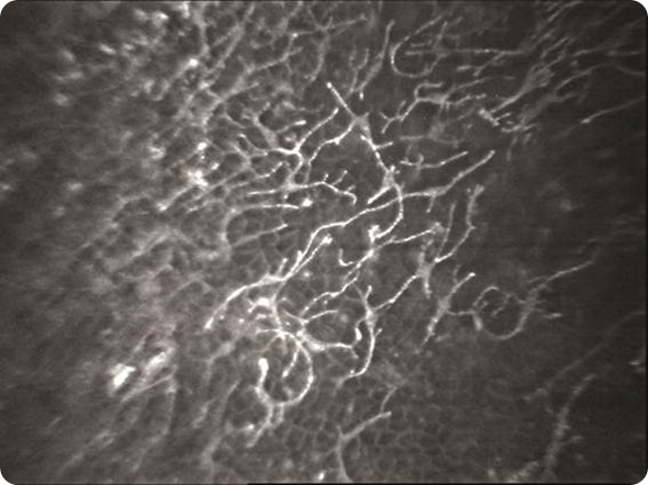 Dendritic cells cornea