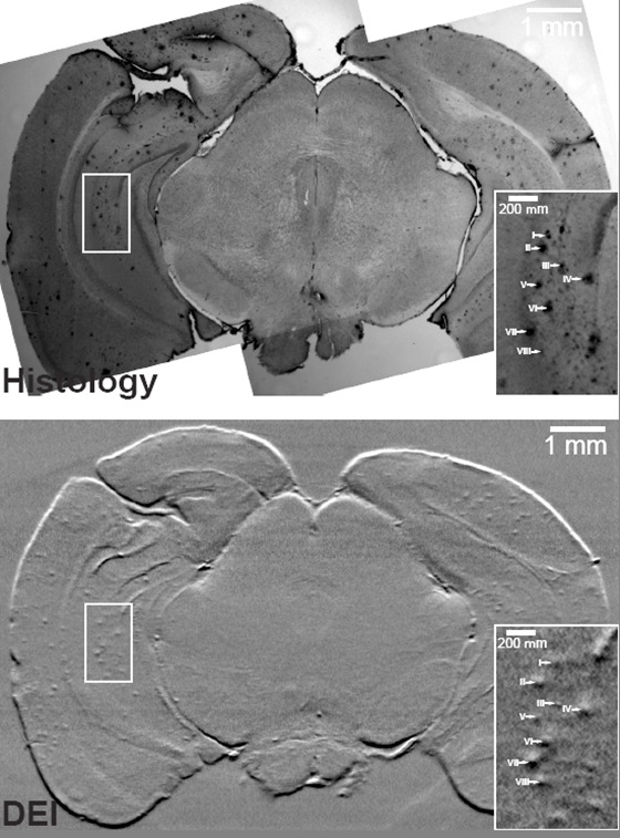 Images of the brain of a transgenic mouse obtained through histology and the corresponding brain region imaged with DEI in computed tomography mode.