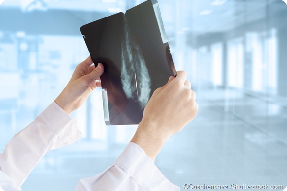 mammography results