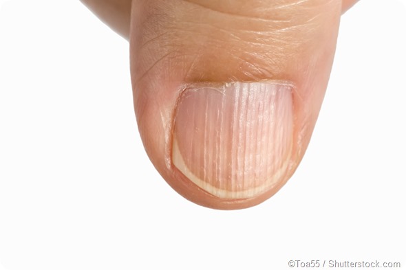3 Causes Of Dark Skin Around Nails