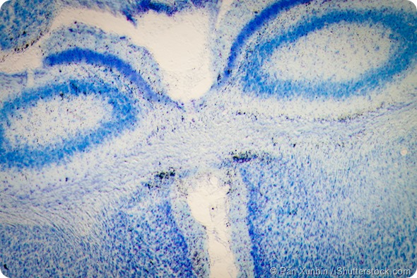 science medical microscopy micrograph, rat brain hippocampal neurons