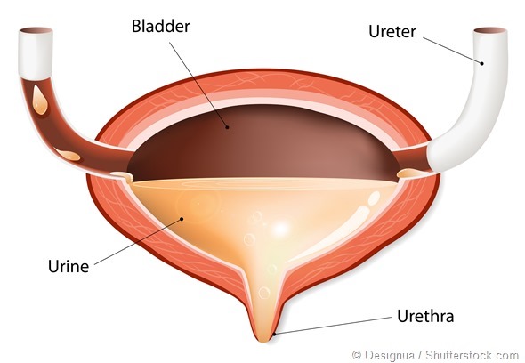 Bladder Control Issues: A common problem that may be overlooked
