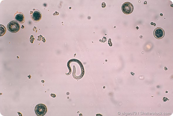 Toxocara larvae