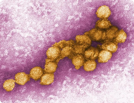 This is a transmission electron micrograph (TEM) of the West Nile virus (WNV). See PHIL 2290 for a black and white version of this image. Photo Credit: Cynthia Goldsmith