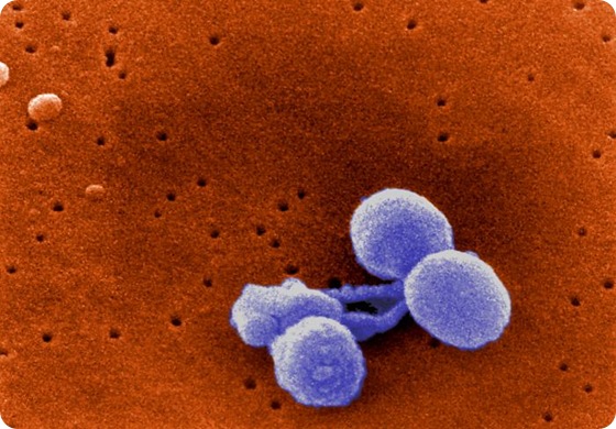 肺炎連鎖球菌スキャン電子顕微鏡写真