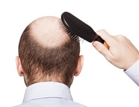 Whey Protein Isolate damages and accelerates hair loss