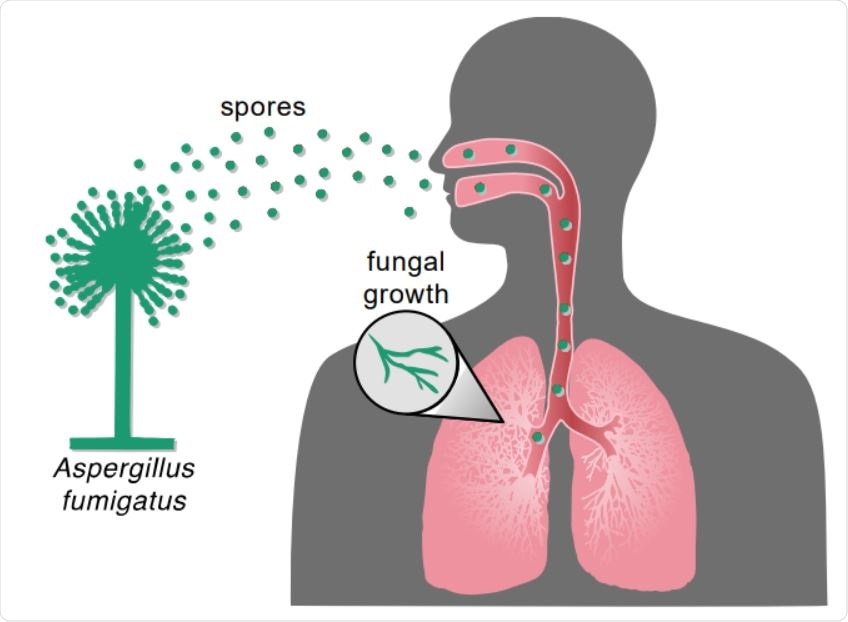 Inhalation of Aspergillus spores can result in fungal infection. 