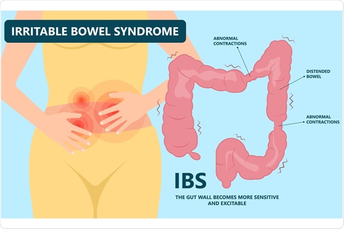 Cause of gay bowel syndrome