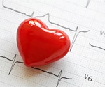 MDI Biological Laboratory researchers receive patent for novel heart disease drug