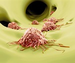 Researchers identify new therapeutic strategies against cancer