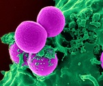 Researchers solve the riddle of superbug toxin damage to gut