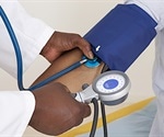 Aggressive blood pressure control may reduce risk of atrial fibrillation