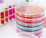 NUS researchers develop portable COVID-19 micro-PCR diagnostic system