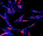 Research shows how immune cells act to limit tumor development