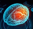 New device uses electromagnetic waves to reverse Alzheimer’s