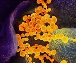 Ibuprofen could increase risk of coronavirus complications