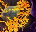 Coronavirus able to survive near boiling point of water, study shows