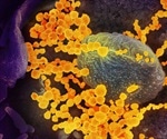 Novel antibody test for SARS-CoV-2