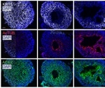 Scientists develop human lung organoids to study SARS-CoV-2 infection