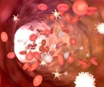 Platelet hyperreactivity, a unique feature of COVID-19