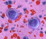 What is Acute Promyelocytic Leukemia (APL)?
