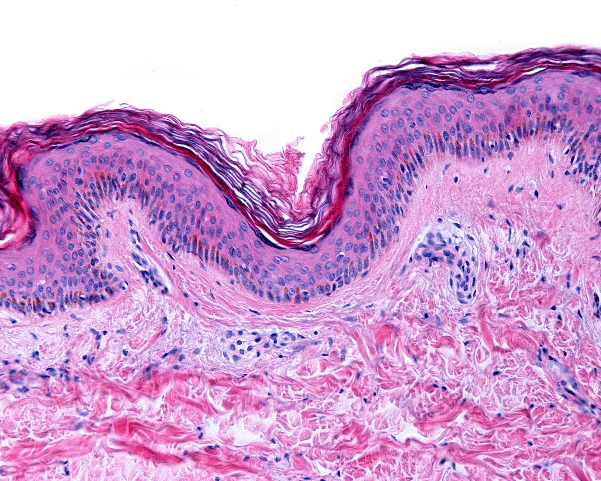 Thin skin showing the epidermis with its different strata, resting on the dermis. Image Credit: Jose Luis Calvo / Shutterstock.com
