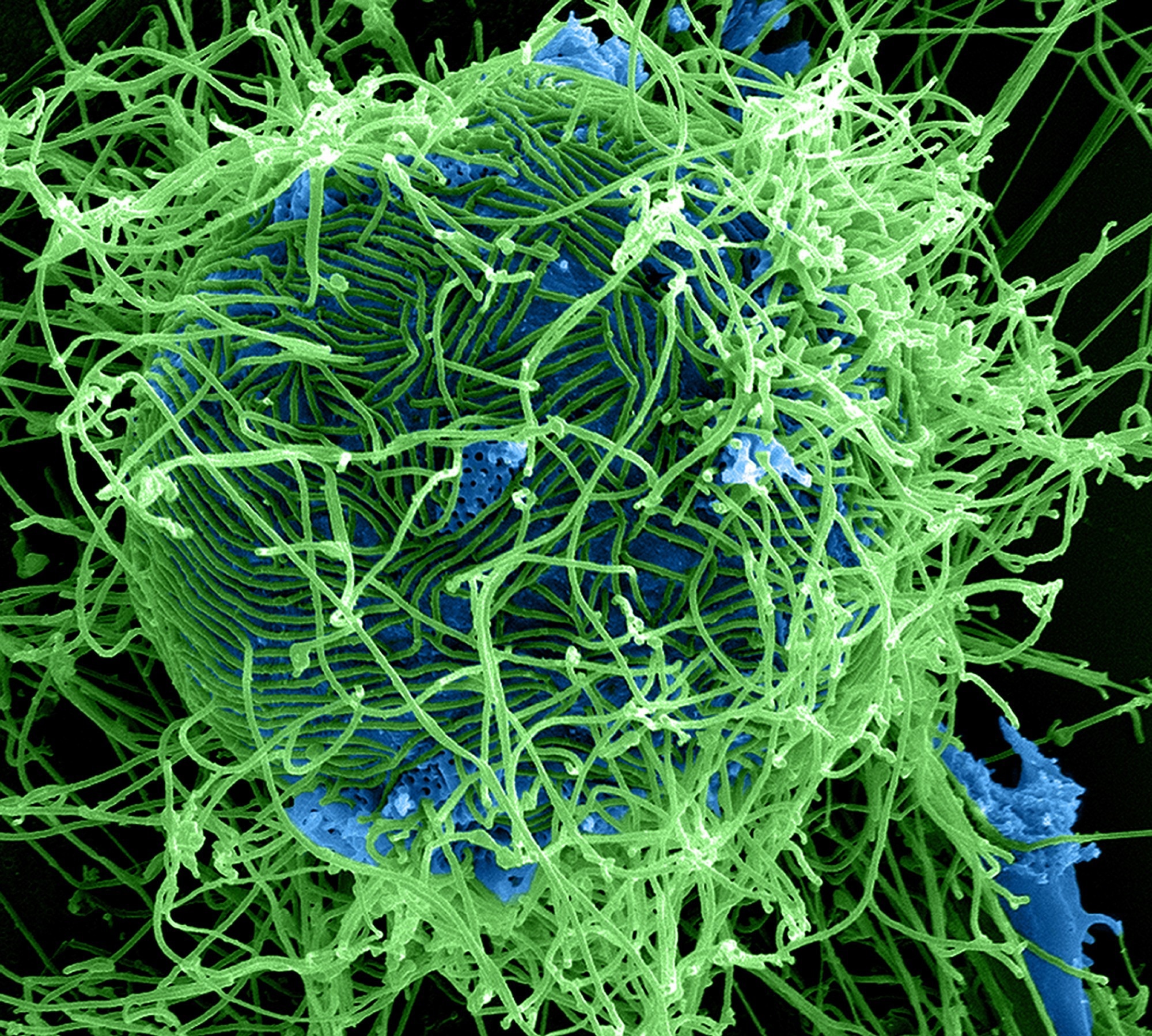 ​​​​​​​Ebola Virus Particles Colorized scanning electron micrograph of filamentous Ebola virus particles (green) attached to and budding from a chronically infected VERO E6 cell (blue) (25,000x magnification). Image captured and color-enhanced at the NIAID Integrated Research Facility in Ft. Detrick, Maryland. Credit: NIAID