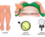 The Genetics of Pre-Eclampsia