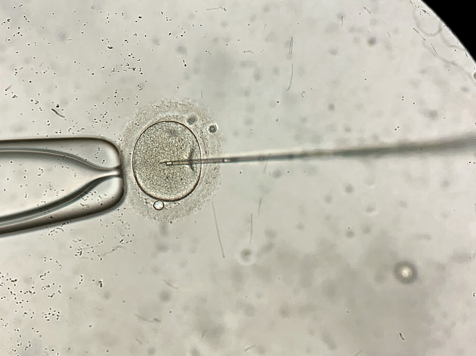 Process of the in vitro fertilization of a female egg inside IVF dish in the laboratory.. Image Credit: bezikus / Shutterstock