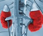 Risk Factors for Chronic Kidney Disease
