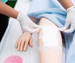 How Could Smart Bandages Revolutionize Wound Care?