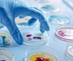Biosafety in Microbiology Laboratories