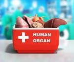 How has COVID-19 affected Organ Transplantation?