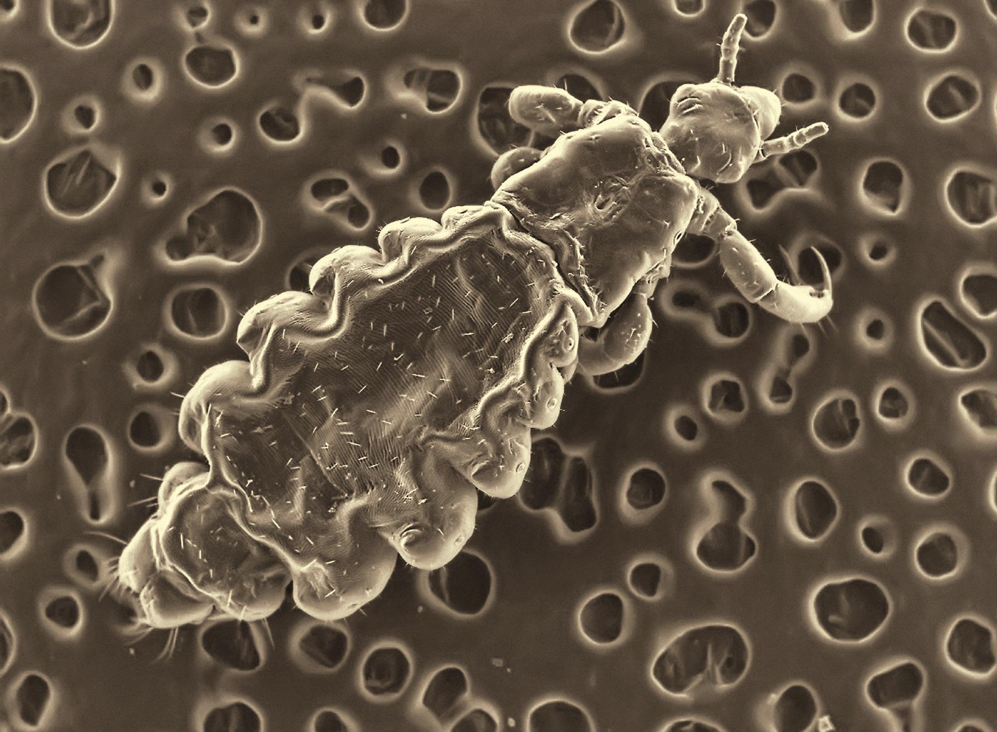 People can get Bartonella quintana from the bite of the human body louse. Image Credit: Protasov AN / Shutterstock