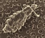 What is Bartonellosis?