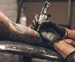 Immune Responses to Tattoos