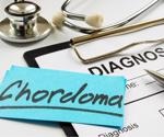 What is Chordoma?