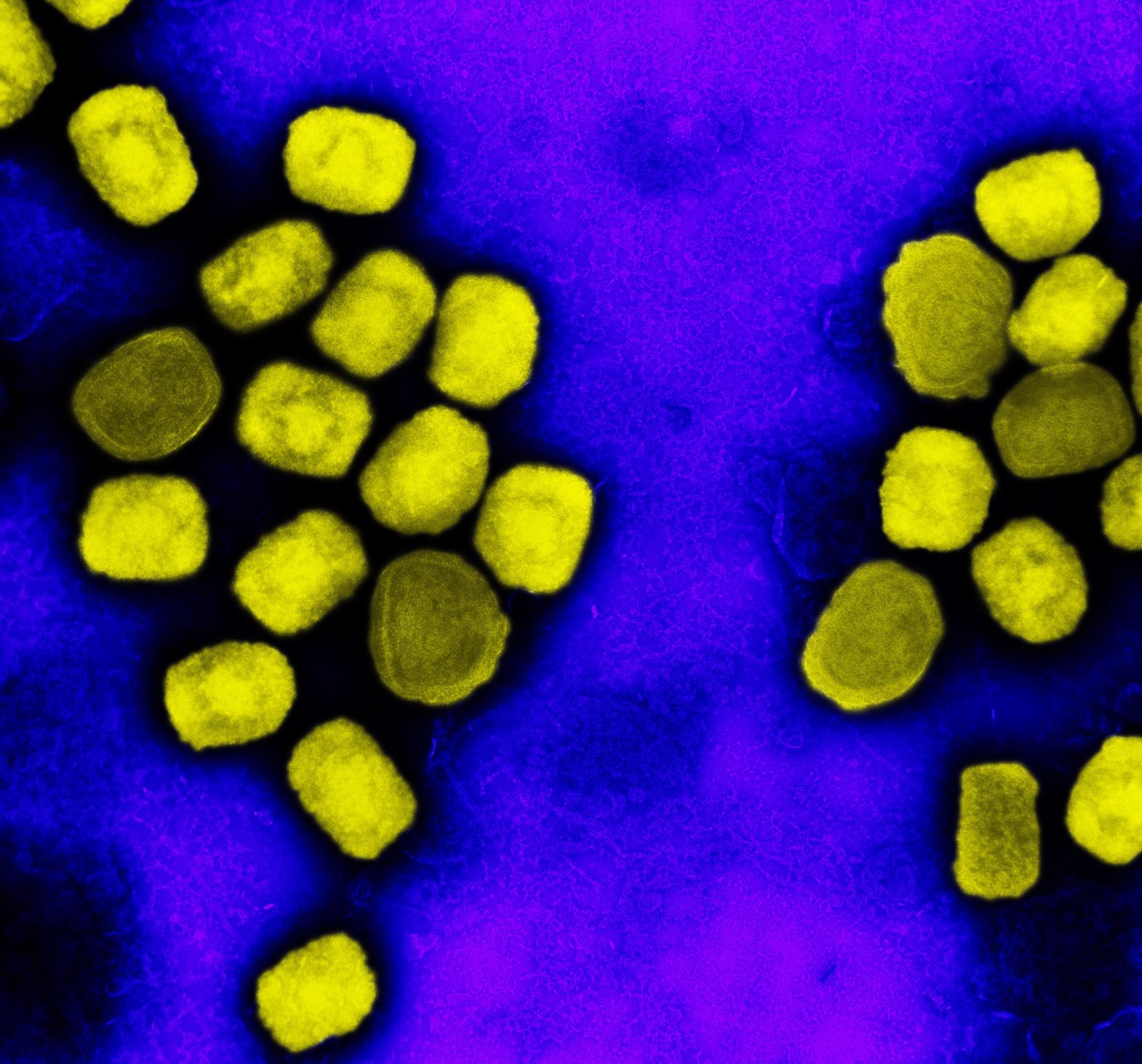 Colorized transmission electron micrograph of monkeypox virus particles (yellow) cultivated and purified from cell culture. Image captured at the NIAID Integrated Research Facility (IRF) in Fort Detrick, Maryland. Credit: NIAID