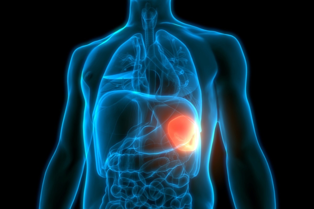The lack or underdevelopment of the spleen is also a hallmark symptom of Ivemark Syndrome. Image Credit: Magic mine/Shutterstock